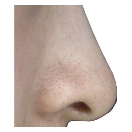 おうちdeエステ 肌をなめらかにするマッサージ洗顔ジェル 炭/ビオレ/その他洗顔料を使ったクチコミ(4枚目)