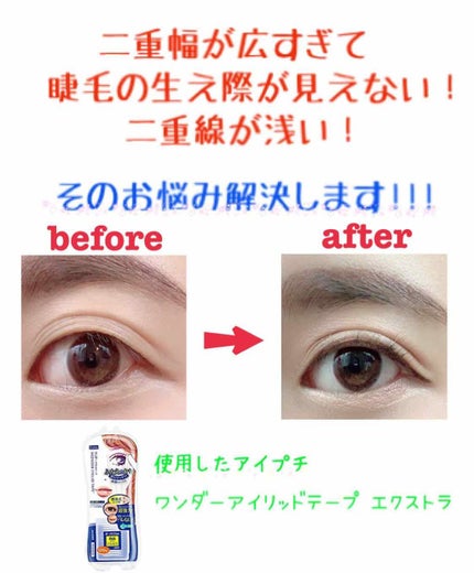 ワンダーアイリッドテープ Extra/D-UP/二重まぶた用アイテムを使ったクチコミ(1枚目)