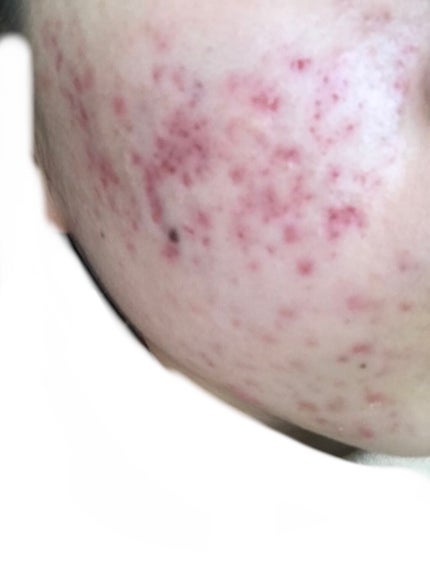 を使ったクチコミ(3枚目)