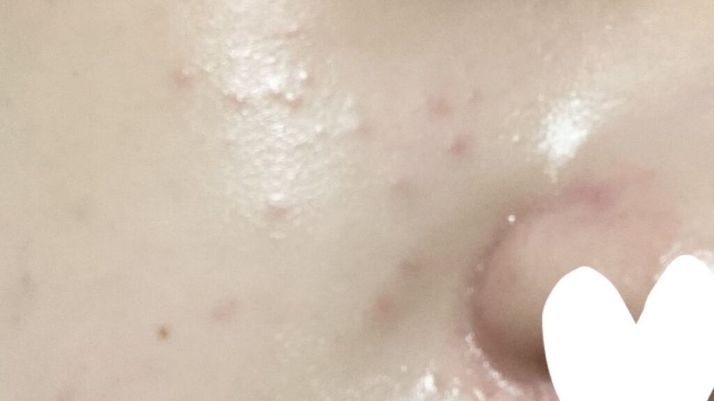 うるおいローション すみっコぐらしデザイン/シンプルバランス/オールインワン化粧品を使ったクチコミ（3枚目）