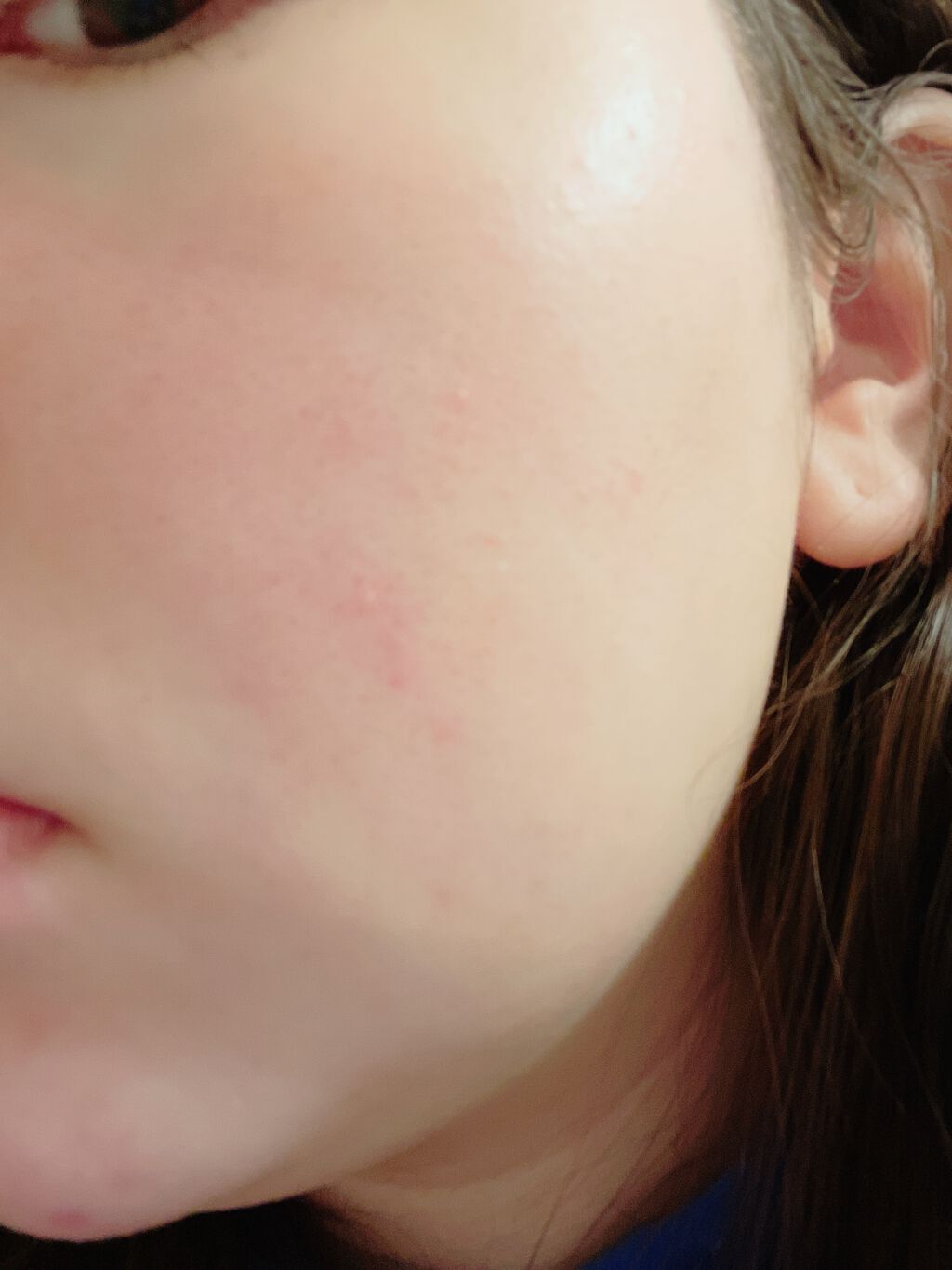 薬用しみ集中対策 プレミアム美容液/メラノCC/美容液を使ったクチコミ(1枚目)