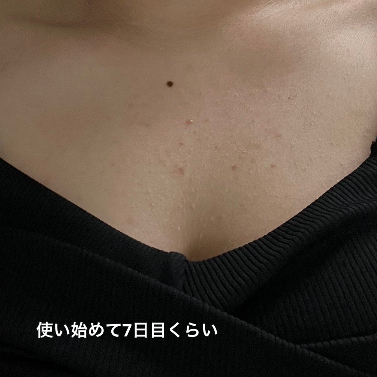 セナキュア(医薬品)/小林製薬/その他を使ったクチコミ(3枚目)