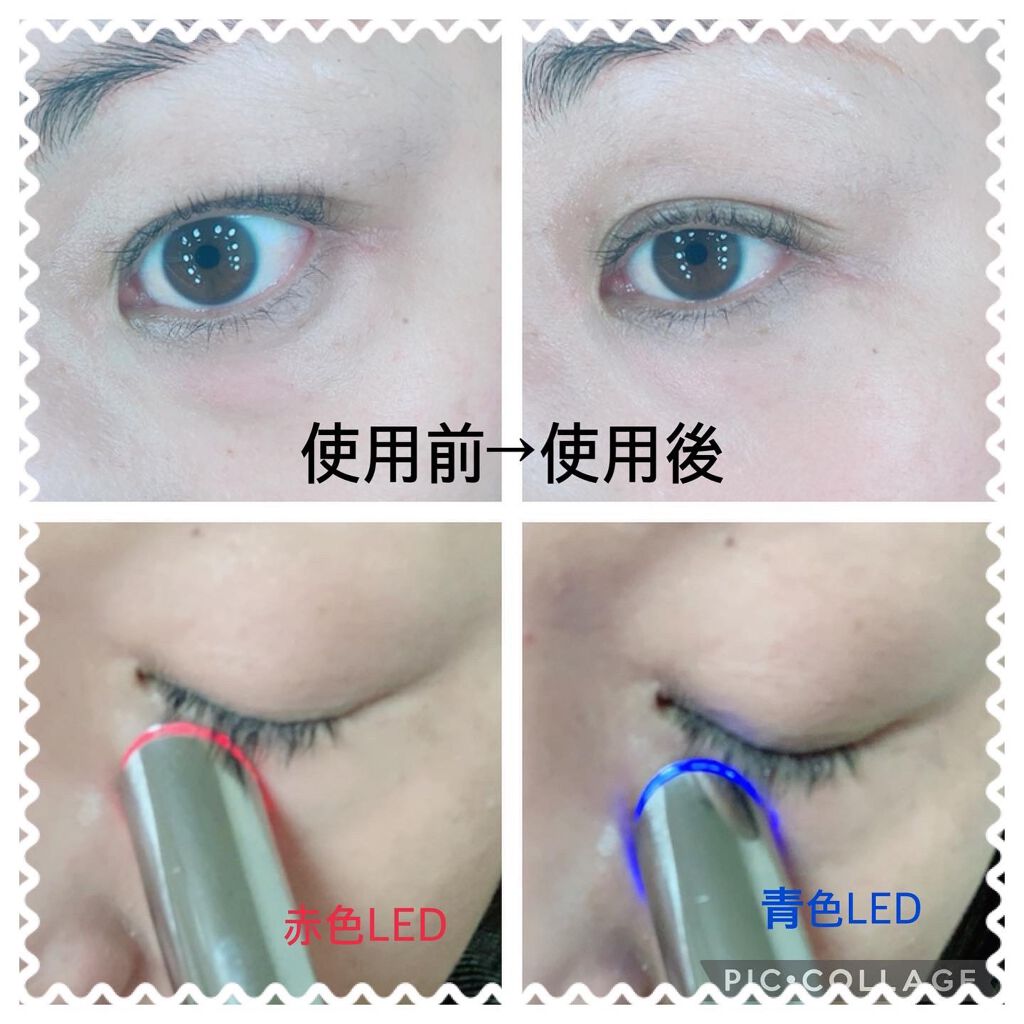 アイケアプロ/Le ment/美顔器・マッサージを使ったクチコミ(3枚目)