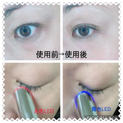 アイケアプロ/Le ment/美顔器・マッサージを使ったクチコミ(3枚目)