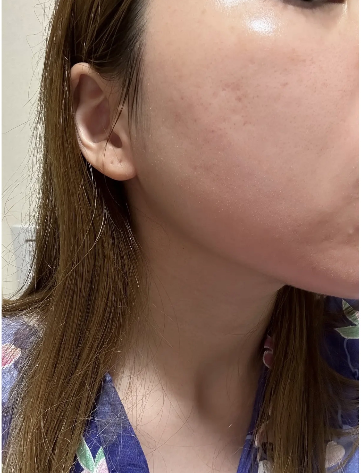 トゥインクルブラック アクアモイスチャーシートマスク/ALFACE+/シートマスク・パックを使ったクチコミ（1枚目）