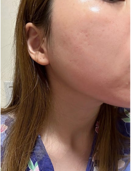 ディープブラック アクアモイスチャー シートマスク/ALFACE+/シートマスク・パックを使ったクチコミ(1枚目)