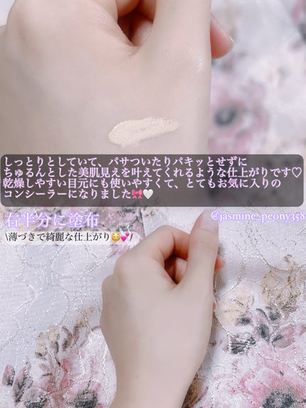 ダーマシンコンシーラー/23years old/リキッドコンシーラーを使ったクチコミ(5枚目)