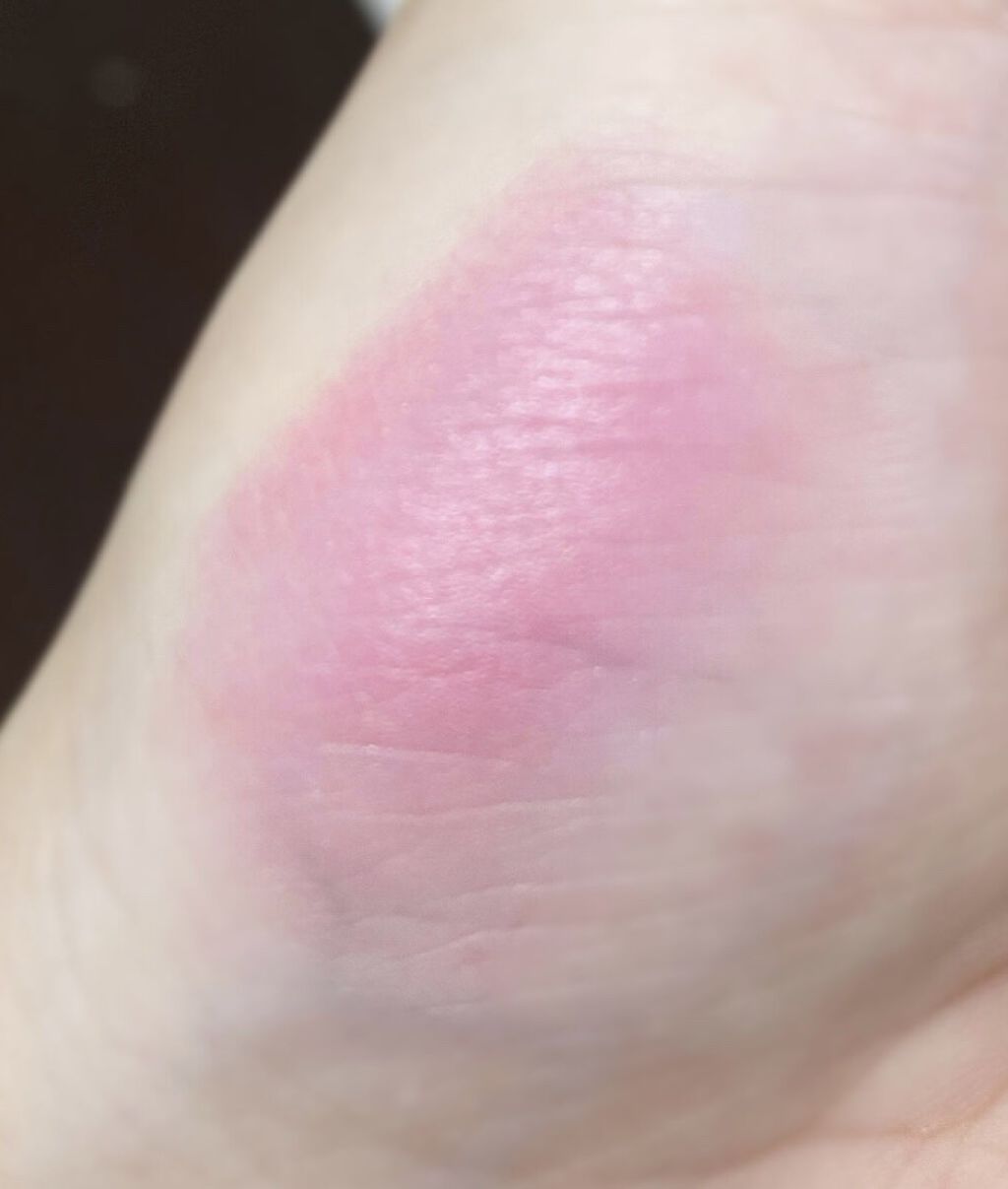 チーク ポップ/CLINIQUE/パウダーチークを使ったクチコミ（2枚目）