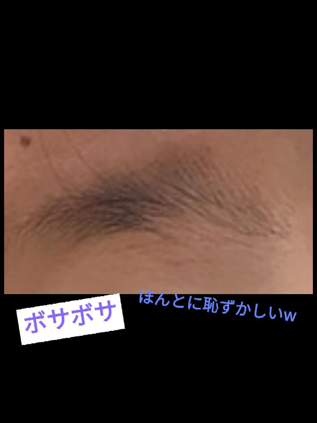 プリティー 敏感肌用フェイスL 3本入/貝印/シェーバーを使ったクチコミ（2枚目）