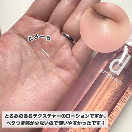 モイストケア ローション MB/d プログラム/化粧水を使ったクチコミ(5枚目)