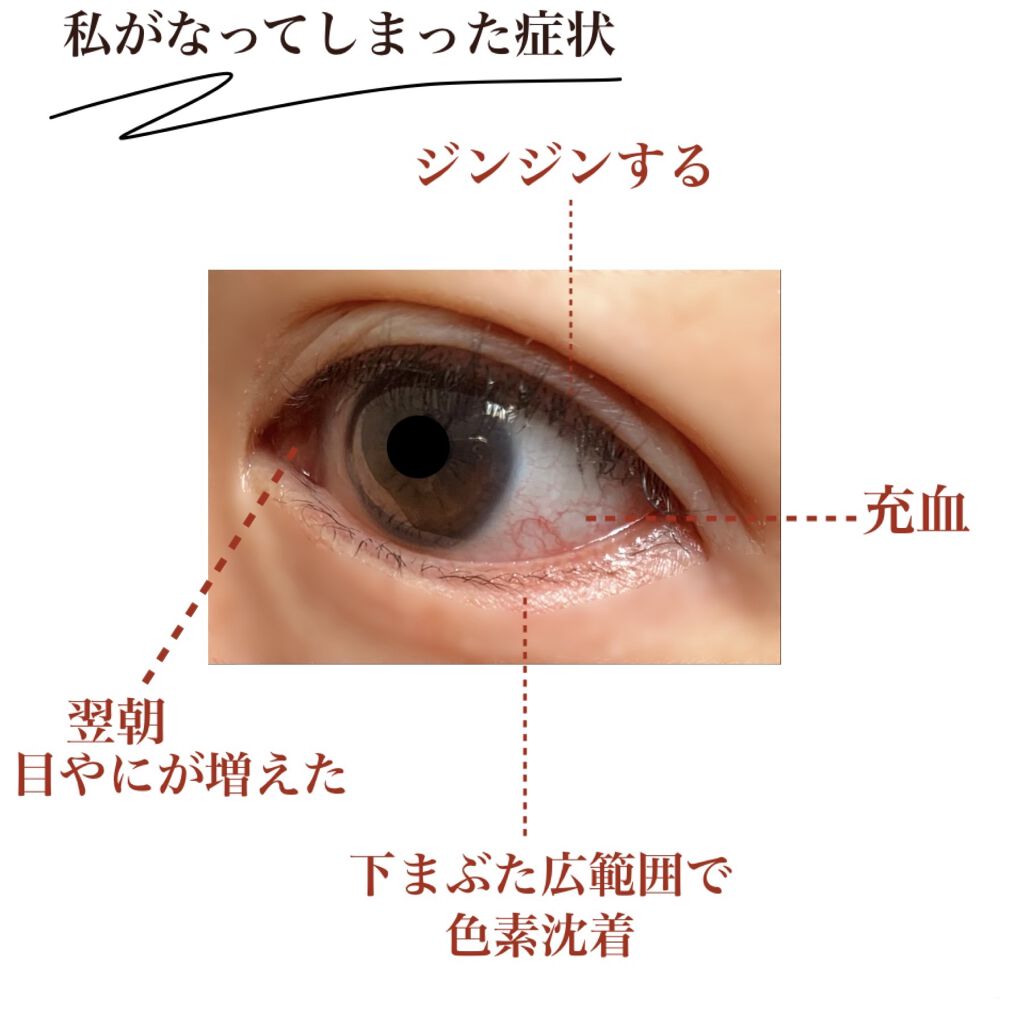 EMAKED（エマーキット）/水橋保寿堂製薬/まつげ美容液を使ったクチコミ（2枚目）