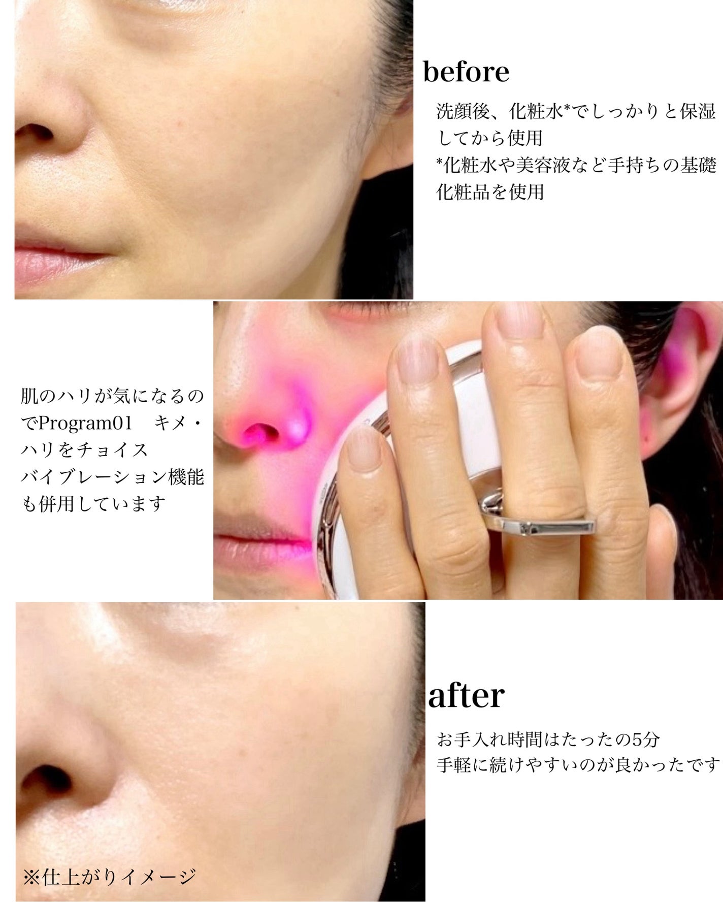 エクスイディアル スフェラ/エクスイディアル/美顔器・マッサージを使ったクチコミ(5枚目)