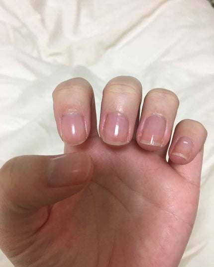 エテュセ クイックケアコート/ettusais/ネイルオイル・トリートメントを使ったクチコミ(1枚目)