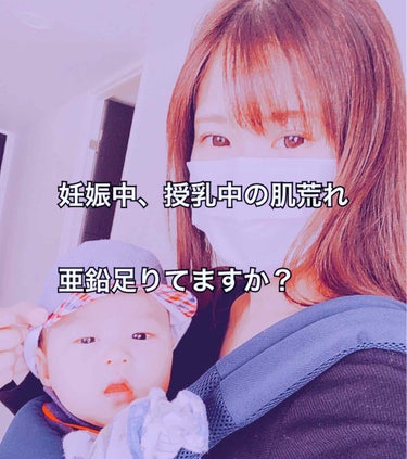 出産して5ヶ月、授乳をしています👶
出産をして楽しいことも多いですが体の変化もありました。

少しでも授乳中で肌荒れに悩んでいる方のご参考になればと思い投稿をさせて頂きます。(長い投稿でごめんなさい💦)