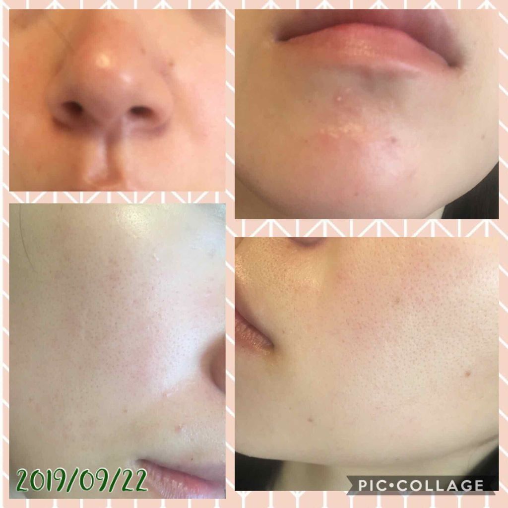 SURISURI /R&/化粧水を使ったクチコミ（3枚目）