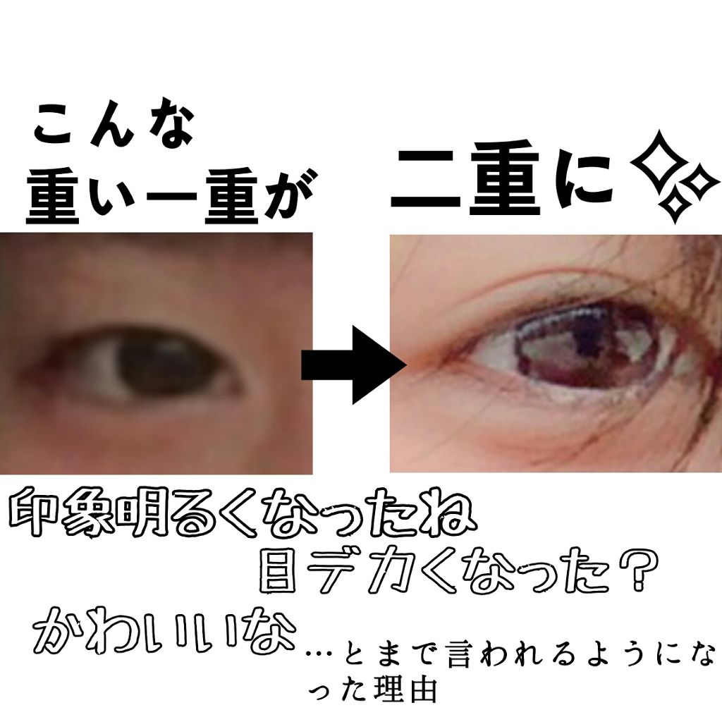 アイトーク/アイトーク/二重まぶた用アイテムを使ったクチコミ（1枚目）