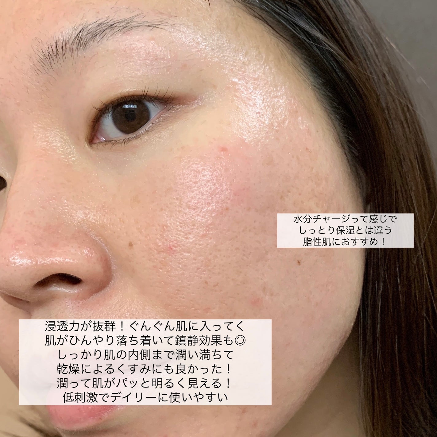 弱酸性pHシートマスク ドクダミフィット/Abib /シートマスク・パックを使ったクチコミ(7枚目)