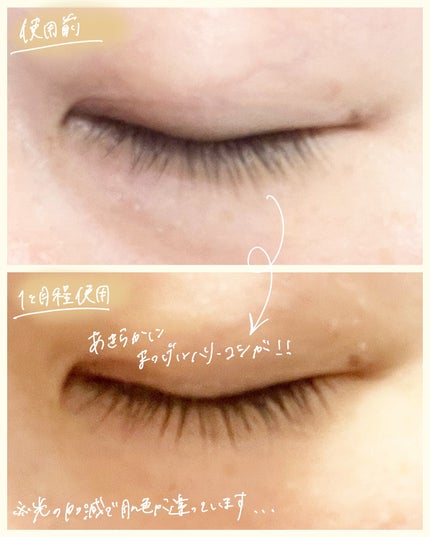 ラッシュリッチアイラッシュセラム/ロート製薬/まつげ美容液を使ったクチコミ(4枚目)