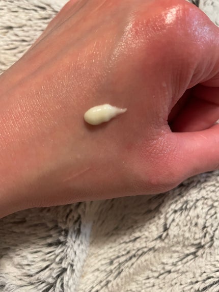 レチノール0.1%クリーム/Frankly/フェイスクリームを使ったクチコミ(3枚目)