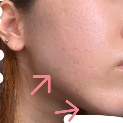 を使ったクチコミ(3枚目)