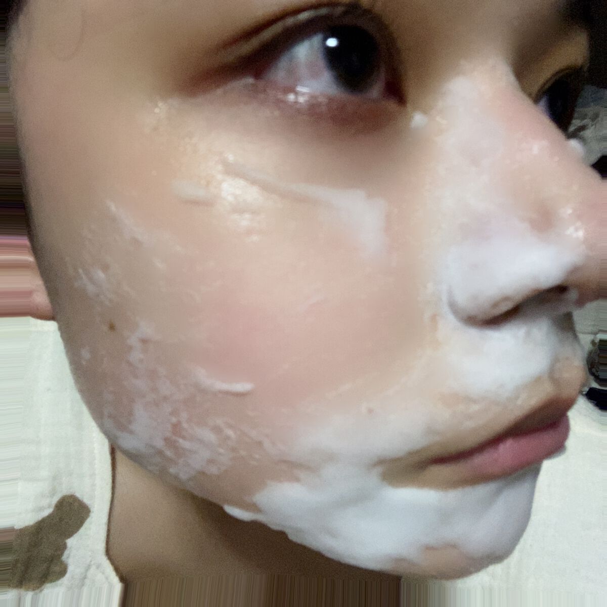 マジックバブルエッセンスパックMINI/BAKER7/シートマスク・パックを使ったクチコミ(3枚目)