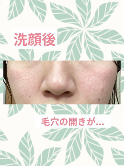 V エッセンス/unlabel/美容液を使ったクチコミ(4枚目)