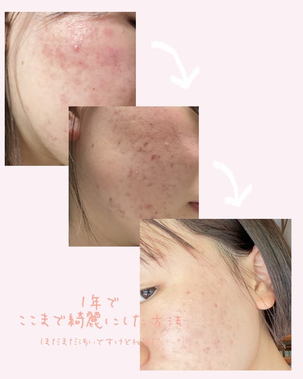 トーンショットクリーム/アバンタイム/フェイスクリームを使ったクチコミ(1枚目)