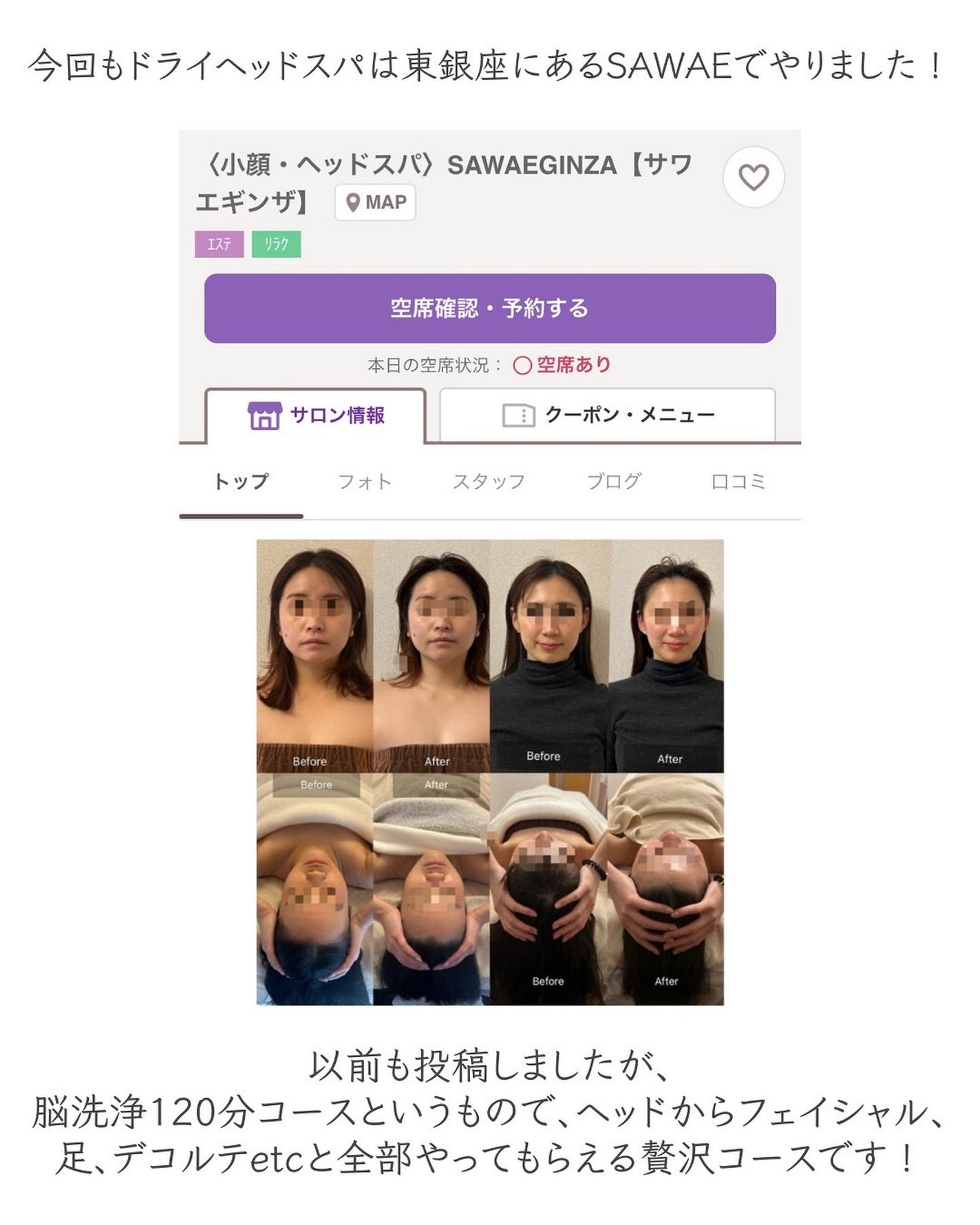 ヒロキ|40歳の美容家 ヘアケア スキンケア on LIPS 「以前も投稿しましたが、銀座のドライヘッドスパ専門店SAWAEで..」(3枚目)