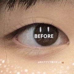 りそうのふたえ 埋没式くっきり形成/DAISO/二重まぶた用アイテムを使ったクチコミ(3枚目)