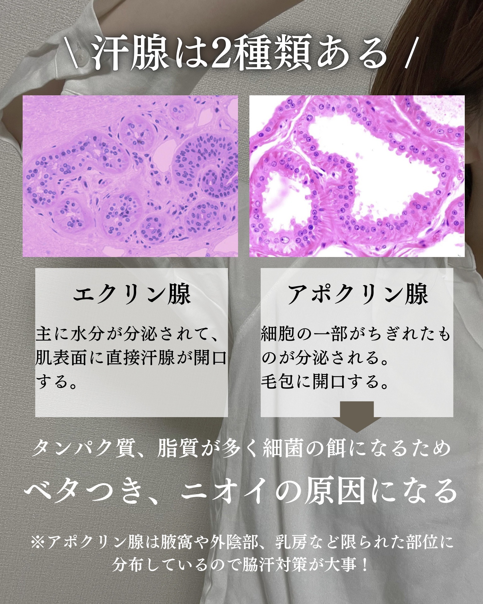 パースピレックス コンフォート/Perspirex/デオドラント・制汗剤を使ったクチコミ（3枚目）