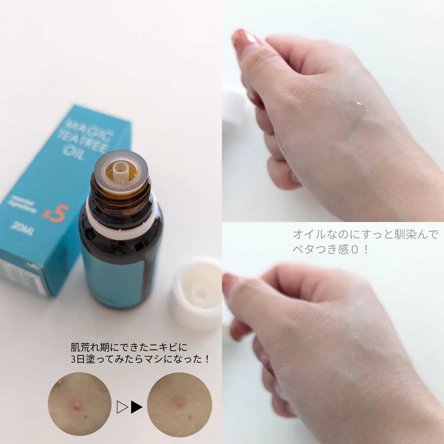マジックティーツリーオイル/ブラン/フェイスオイルを使ったクチコミ（2枚目）