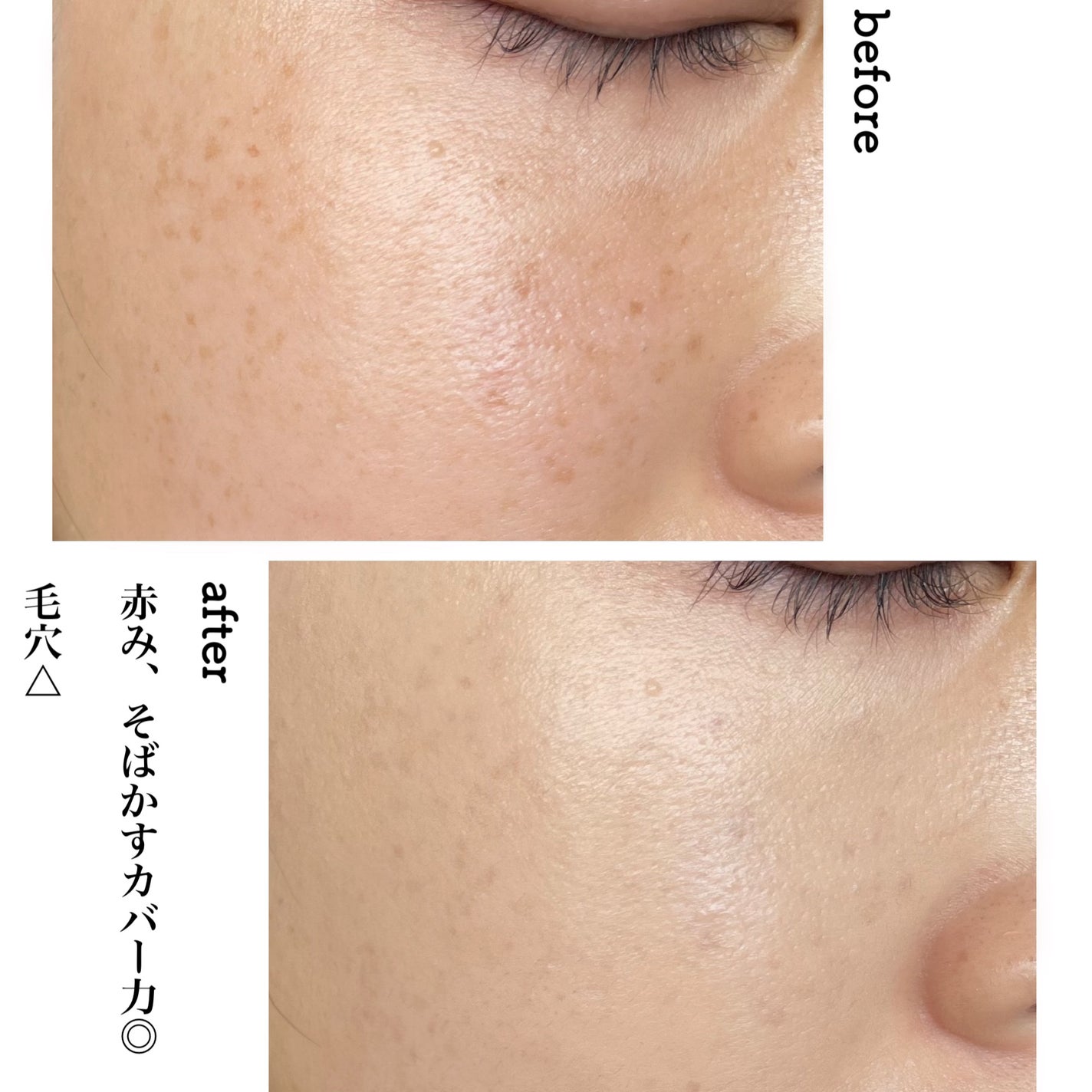 ダーマシンコンシーラー/23years old/リキッドコンシーラーを使ったクチコミ(4枚目)