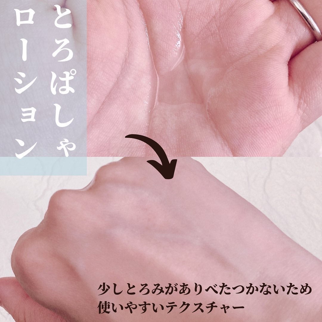 オルビスユー エッセンスローション /オルビス/化粧水を使ったクチコミ(4枚目)