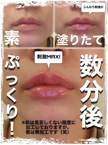 ドトムリッププラスプランパー/keybo/リッププランパーを使ったクチコミ(2枚目)