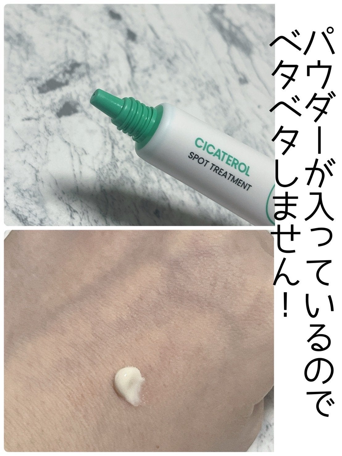 シカテロル スポットトリートメント/beplain/フェイスクリームを使ったクチコミ(2枚目)