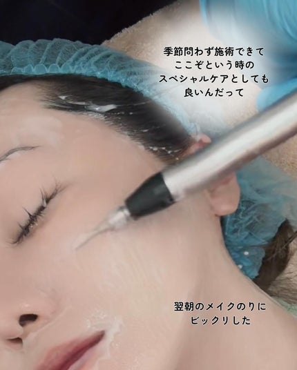 marc♡美容垢フォロバ on LIPS 「♡メソナJ通常塗布の300倍!エレクトロポーションの70倍と言..」(5枚目)