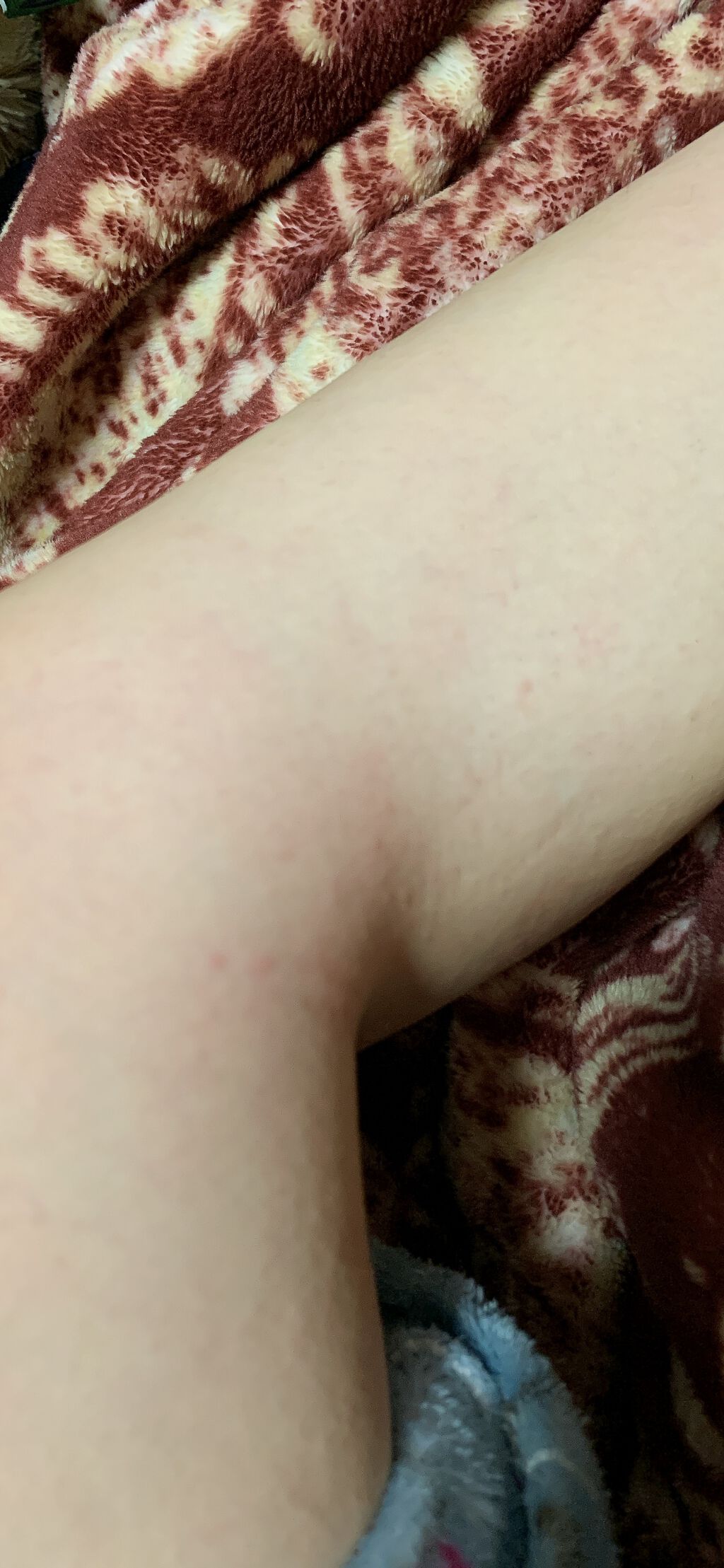 ヴァセリン アドバンスドリペア ボディローション 無香料/ヴァセリン/ボディローションを使ったクチコミ(2枚目)