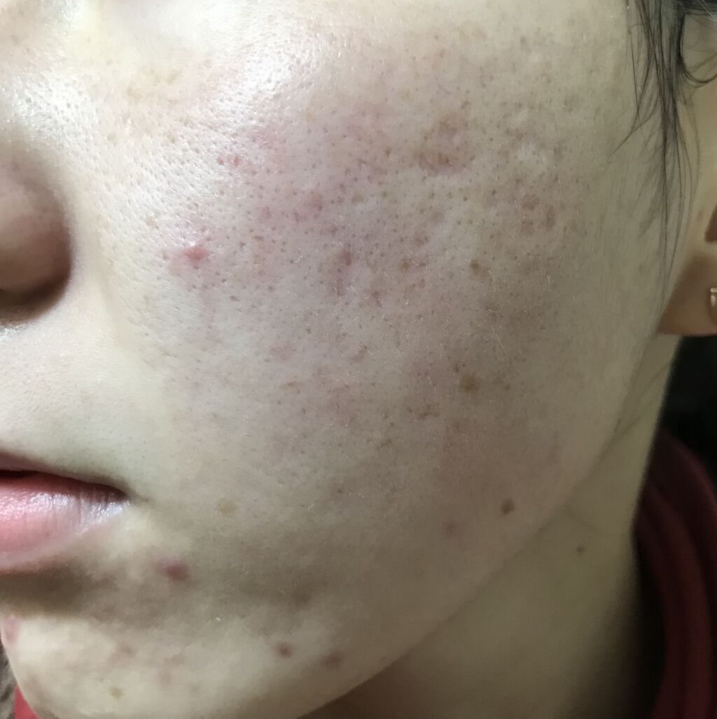 リバイタライジングビタミンAコンプレックス/Sympli Beautiful/美容液を使ったクチコミ（2枚目）