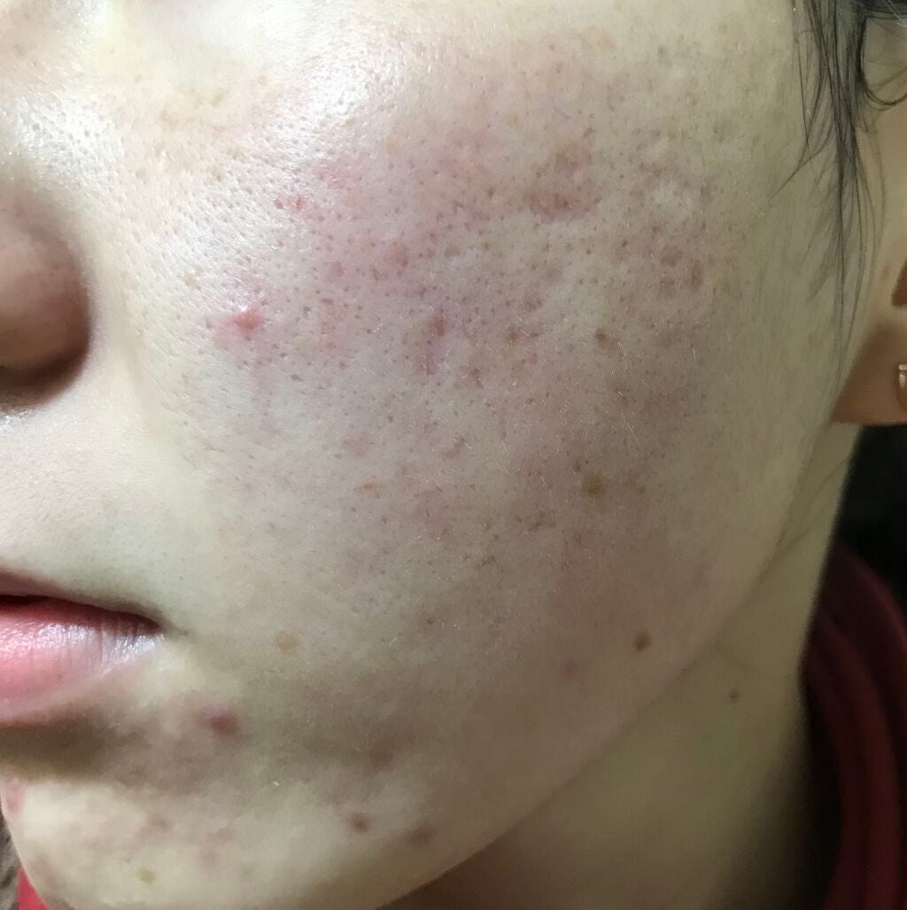 ラディアントクリーミーコンシーラー/NARS/リキッドコンシーラーを使ったクチコミ(2枚目)