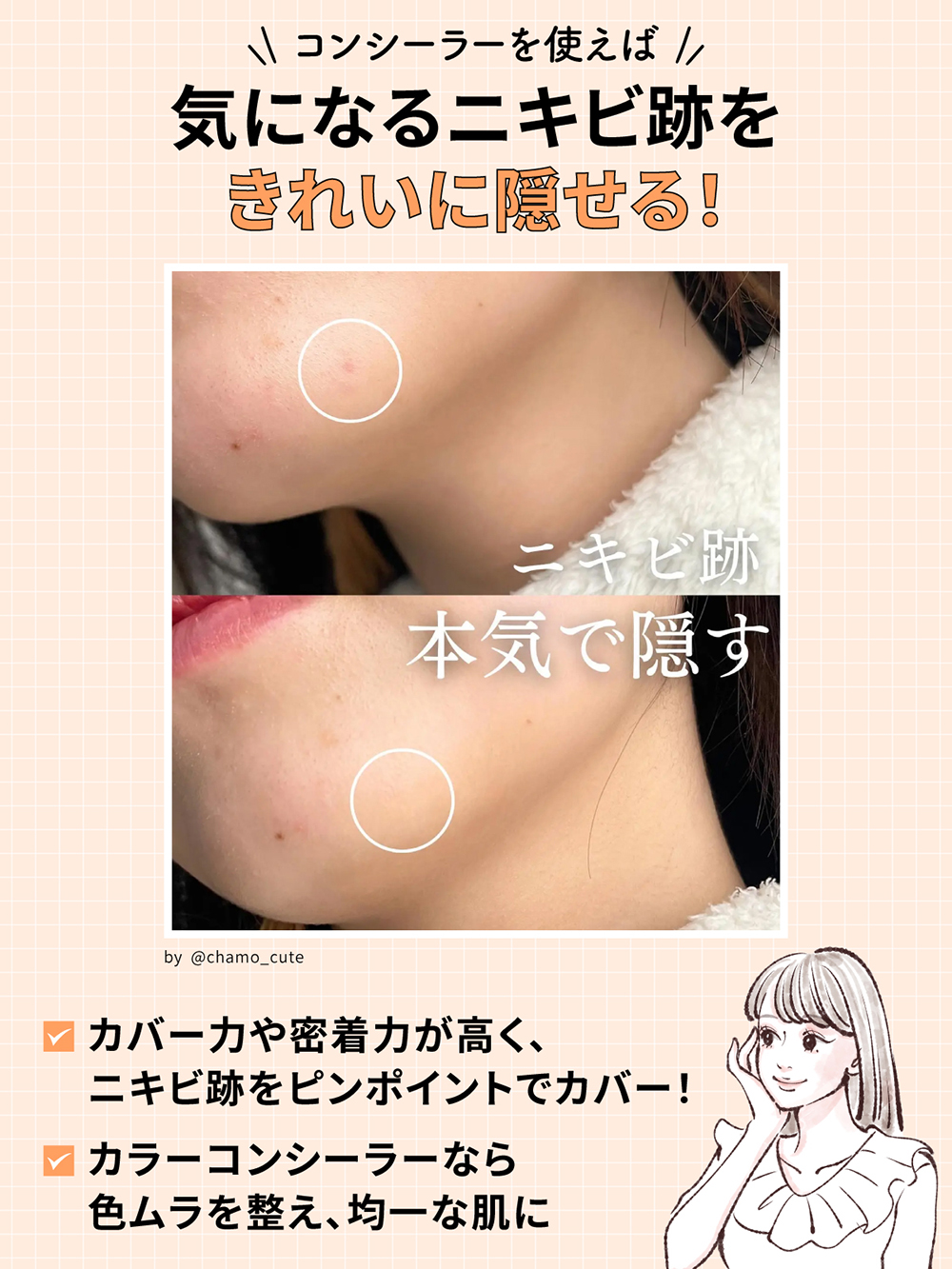 コンシーラーを使えば気になるニキビ跡をきれいに隠せる！カバー力や密着力が高く、ニキビ跡をピンポイントでカバーしカラーコンシーラーなら色ムラを整えて均一な肌になるのがメリット。