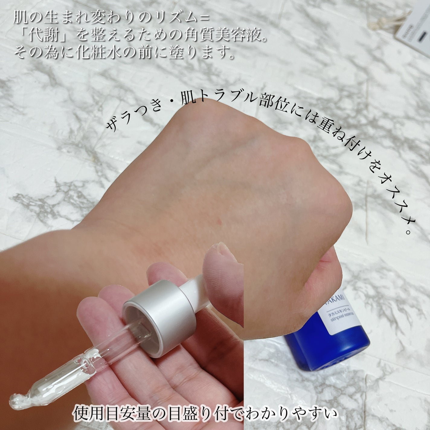 タカミスキンピール/タカミ/ブースター・導入液を使ったクチコミ(2枚目)