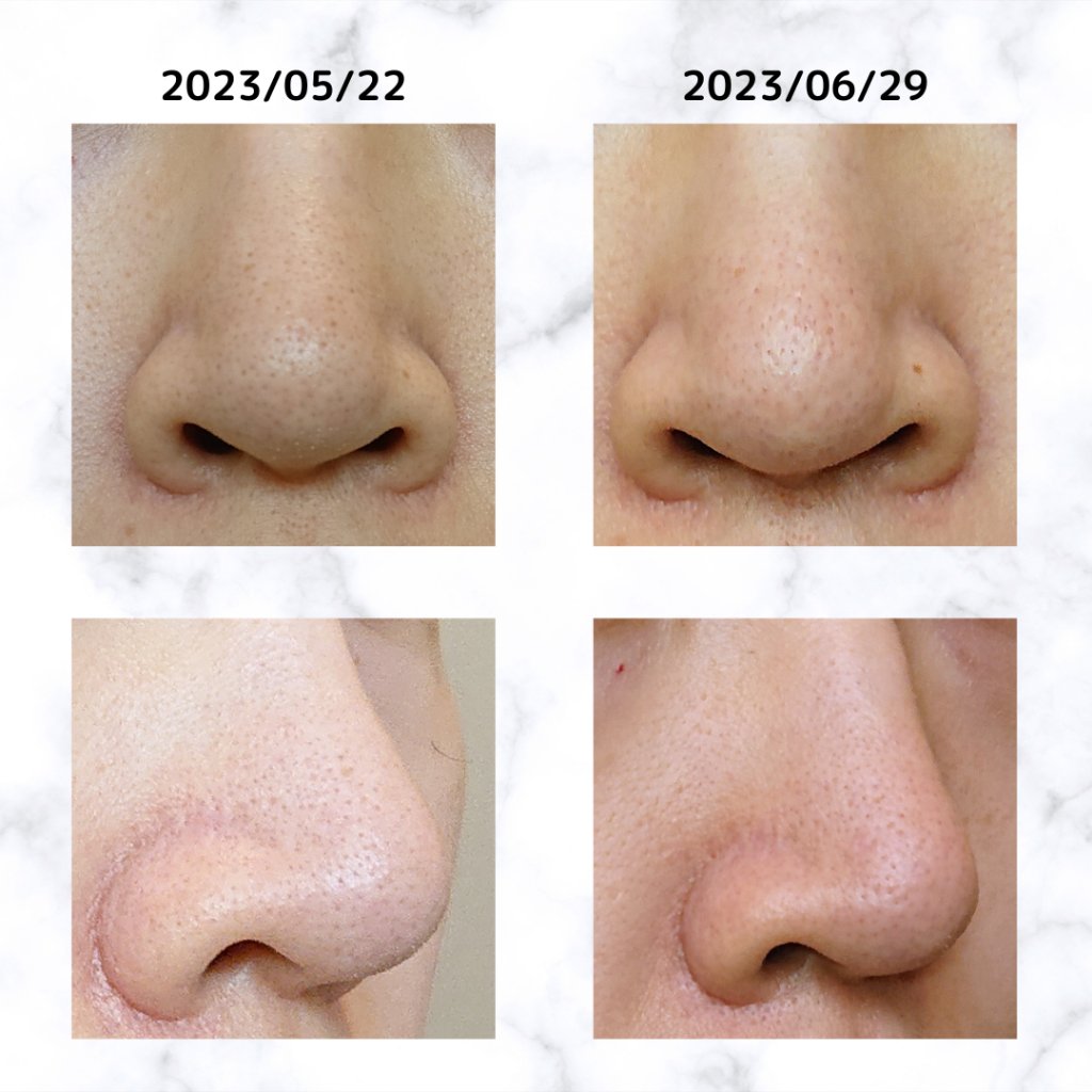 バブルガード/シャボン玉石けん/ハンドソープを使ったクチコミ（3枚目）