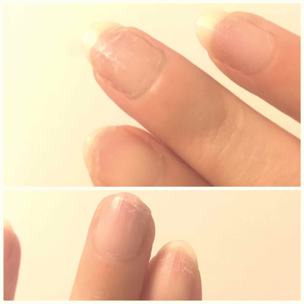 ネイルホリック ベースコート/ネイルホリック/ネイルベースコートを使ったクチコミ(3枚目)