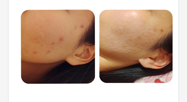 カスターオイル(ひまし油)/生活の木/ボディオイルを使ったクチコミ(2枚目)