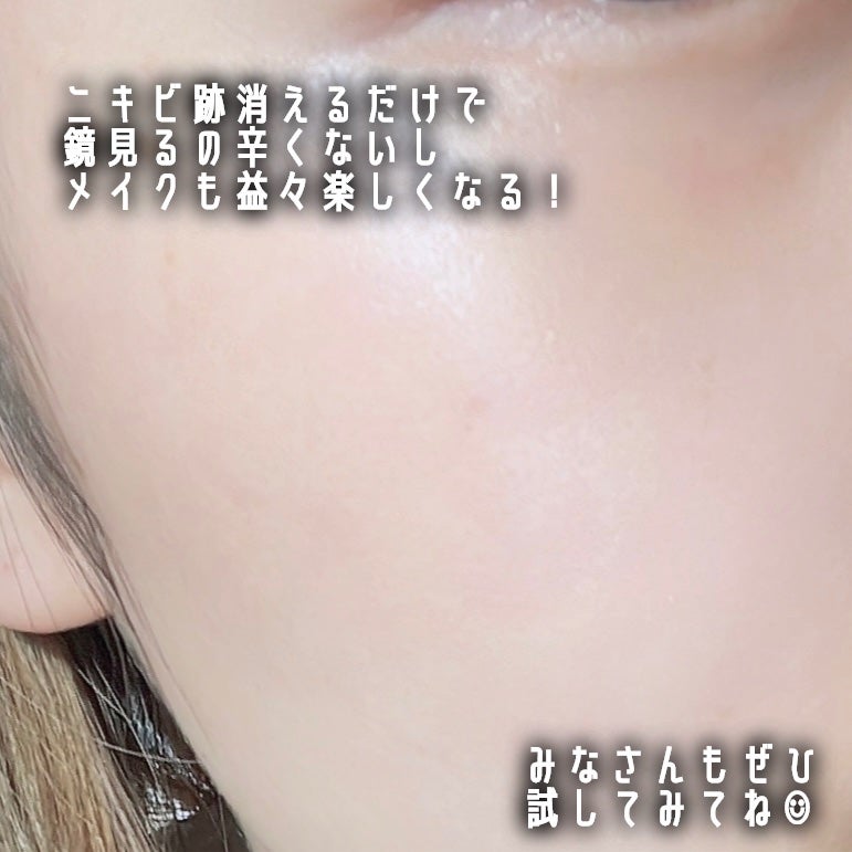 レチノール0.1%クリーム/Frankly/フェイスクリームを使ったクチコミ(5枚目)