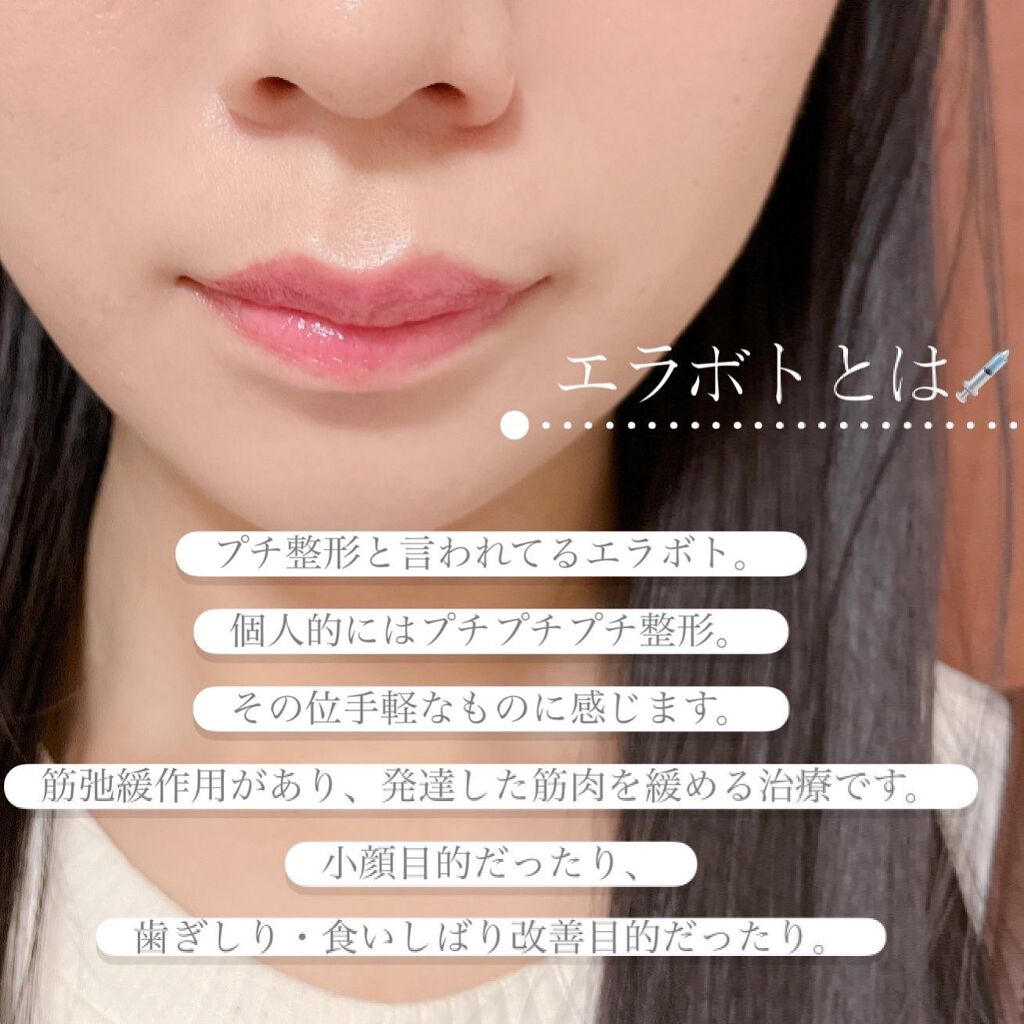 ぴーちゃん🧡インスタでコメント返信 on LIPS 「1ヶ月経過報告~👏約1年振り2回目のエラボトックス。普通に肉眼..」(6枚目)
