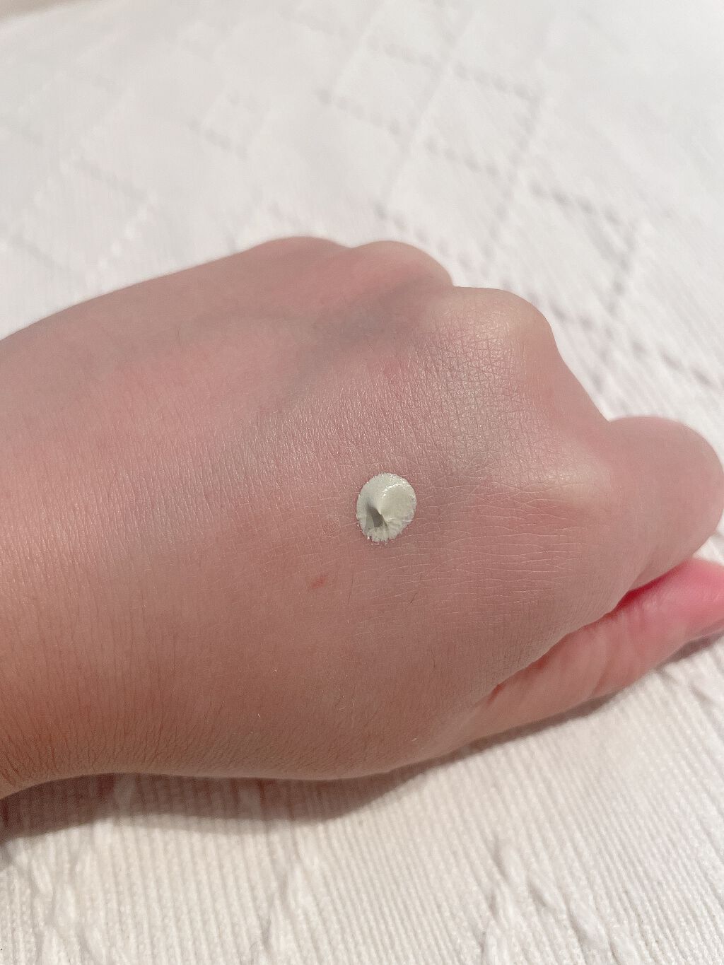 ドクタージャルト シカペア リカバー (第2世代)/Dr.Jart+/フェイスクリームを使ったクチコミ(2枚目)