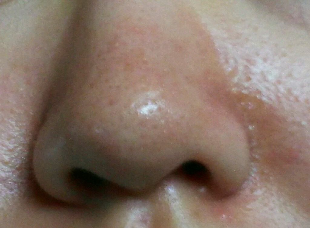 薬用パウダー化粧水/メンソレータム アクネス/化粧水を使ったクチコミ（3枚目）