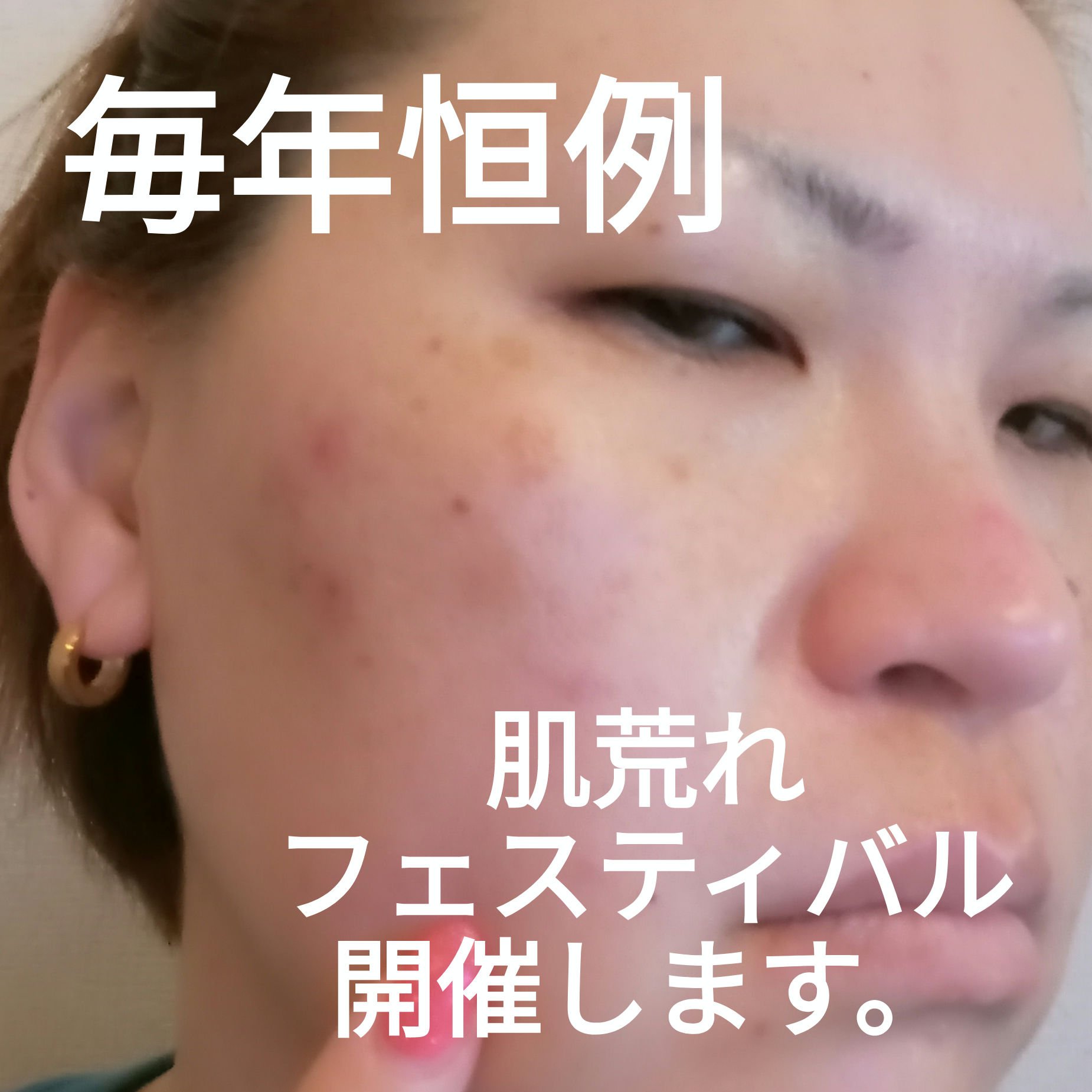 クリアケア化粧水/無印良品/化粧水を使ったクチコミ（1枚目）