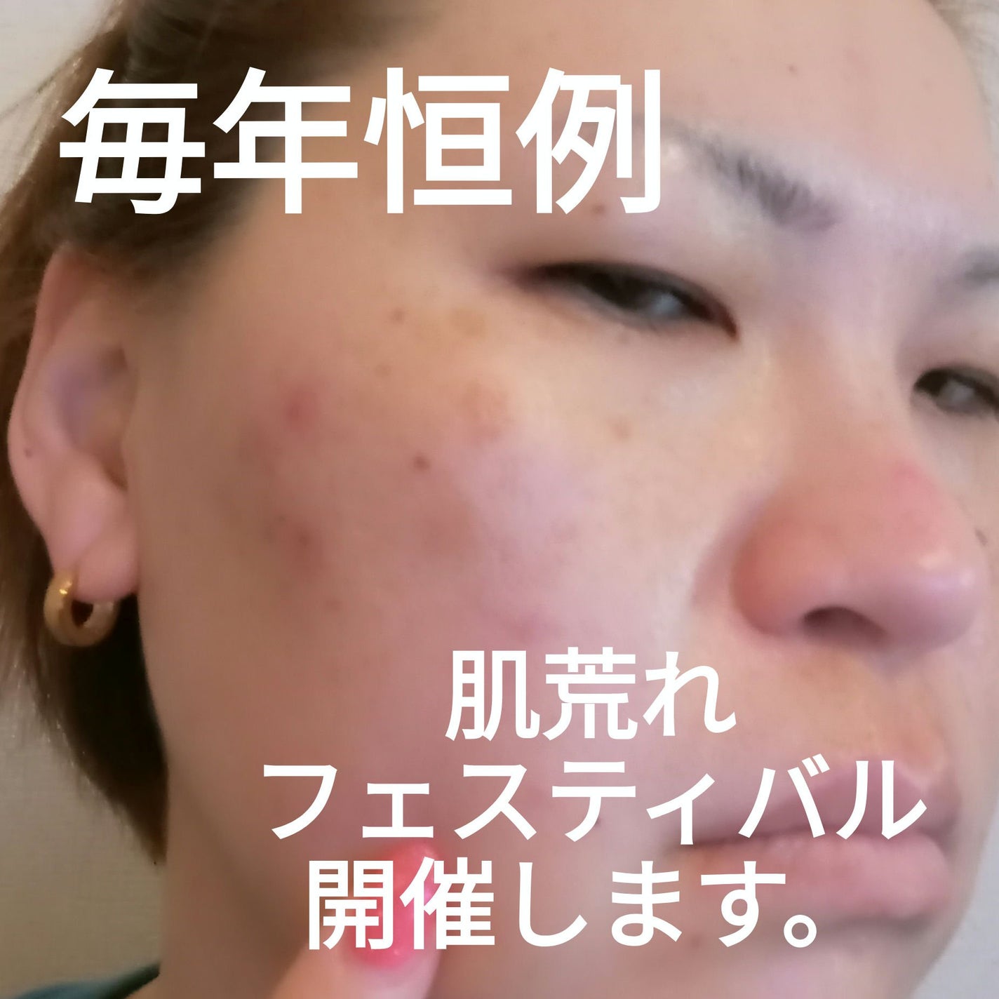 クリアケア化粧水/無印良品/化粧水を使ったクチコミ(1枚目)